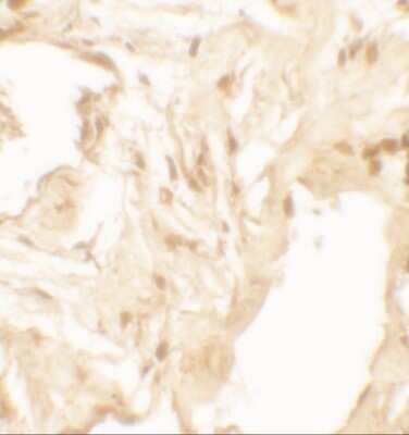 Immunohistochemistry: IL-36 beta/IL-1F8 Antibody - BSA Free [NBP2-41239]