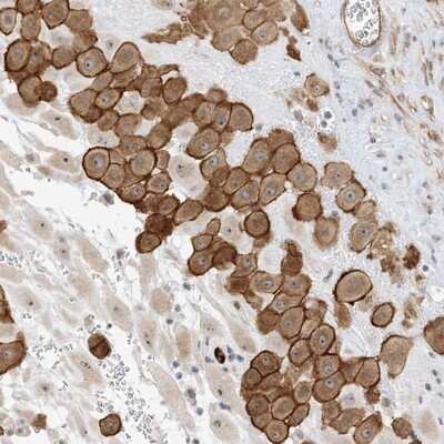 Immunohistochemistry-Paraffin: IL-36 beta/IL-1F8 Antibody [NBP1-83892]