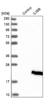 Western Blot: IL-36 beta/IL-1F8 Antibody [NBP1-83892]