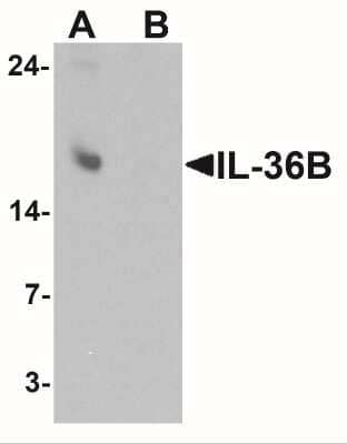 Western Blot: IL-36 beta/IL-1F8 AntibodyBSA Free [NBP2-41239]