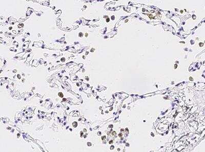 Immunohistochemistry-Paraffin: IL-36 gamma/IL-1F9 Antibody (013) [NBP2-89281]