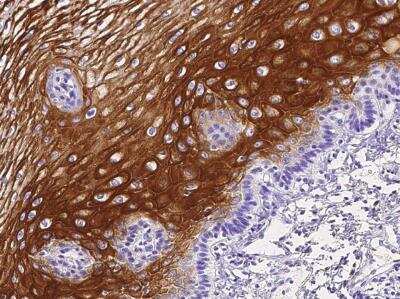 Immunohistochemistry-Paraffin: IL-36 gamma/IL-1F9 Antibody (013) [NBP2-89281]