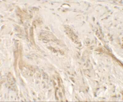 Immunohistochemistry-Paraffin: IL-36 gamma/IL-1F9 Antibody - BSA Free [NBP2-41240]