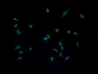 Immunocytochemistry/ Immunofluorescence: IL-36 gamma/IL-1F9 Antibody (OTI2F4) - Azide and BSA Free [NBP2-72055]