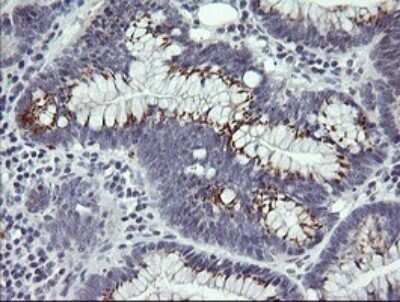 Immunohistochemistry: IL-36 gamma/IL-1F9 Antibody (OTI2F4) - Azide and BSA Free [NBP2-72055]