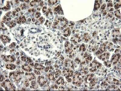 Immunohistochemistry: IL-36 gamma/IL-1F9 Antibody (OTI2F4) - Azide and BSA Free [NBP2-72055]
