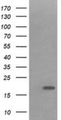 Western Blot: IL-36 gamma/IL-1F9 Antibody (OTI2F4)Azide and BSA Free [NBP2-72055]