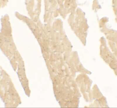 Immunohistochemistry: IL-36Ra/IL-1F5 Antibody - BSA Free [NBP2-41241]