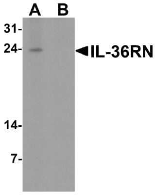 Western Blot: IL-36Ra/IL-1F5 AntibodyBSA Free [NBP2-41241]