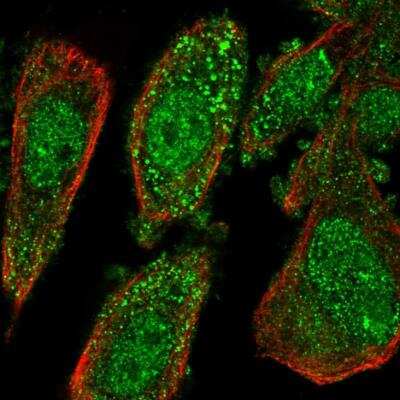 Immunocytochemistry/ Immunofluorescence: IL-37/IL-1F7 Antibody [NBP2-34208]