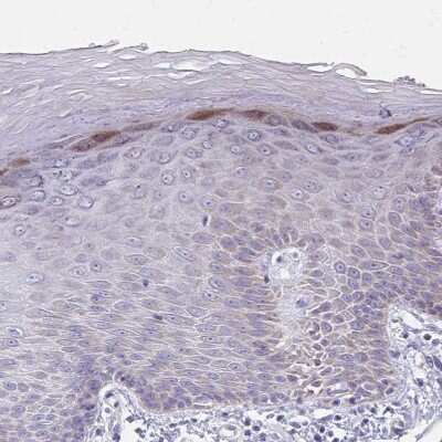 Immunohistochemistry-Paraffin: IL-37/IL-1F7 Antibody [NBP2-33712]