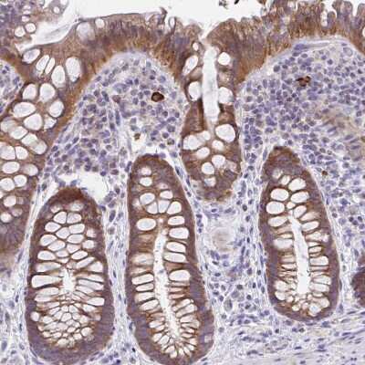 Immunohistochemistry-Paraffin: IL-37/IL-1F7 Antibody [NBP2-33712]