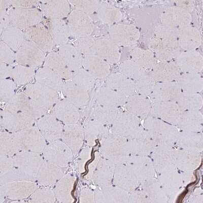 Immunohistochemistry-Paraffin: IL-37/IL-1F7 Antibody [NBP2-33712]
