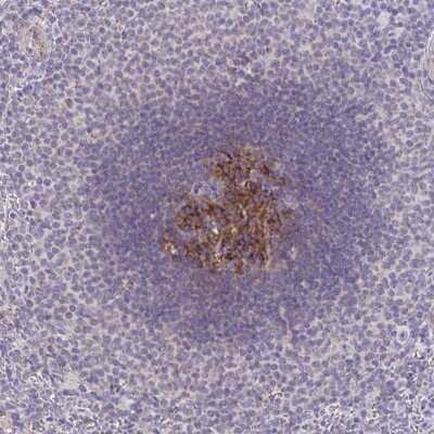 Immunohistochemistry-Paraffin: IL-37/IL-1F7 Antibody [NBP2-34208]