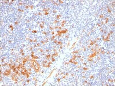 Immunohistochemistry-Paraffin: IL-3R alpha/CD123 Antibody (IL3RA/2947R) - Azide and BSA Free [NBP2-79851]