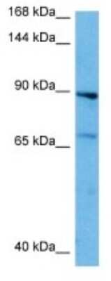 Western Blot: IL-3R beta Antibody [NBP3-10030]