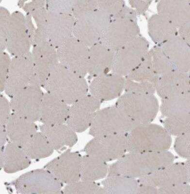 Immunohistochemistry-Paraffin: IL-40 Antibody [NBP1-93716]