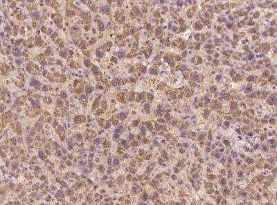 Immunohistochemistry-Paraffin: IL-40 Antibody [NBP3-05944]