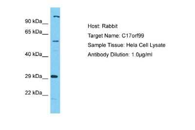 Western Blot: IL-40 Antibody [NBP2-83076]