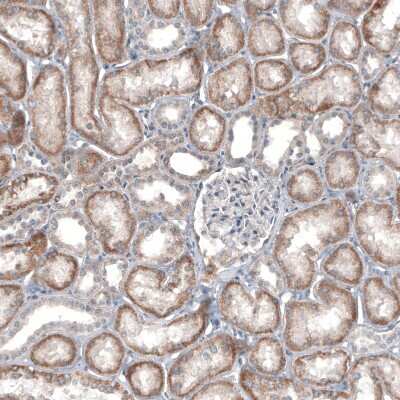 Immunohistochemistry-Paraffin: IL-4I1 Antibody (CL9071) [NBP2-88929]