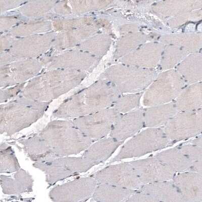 Immunohistochemistry-Paraffin: IL-4I1 Antibody (CL9071) [NBP2-88929]