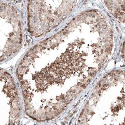 Immunohistochemistry-Paraffin: IL-4I1 Antibody (CL9071) [NBP2-88929]