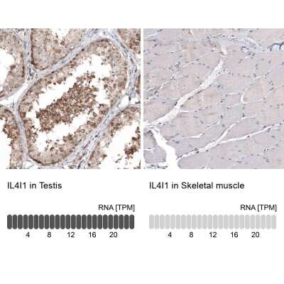 Immunohistochemistry-Paraffin: IL-4I1 Antibody (CL9071) [NBP2-88929]