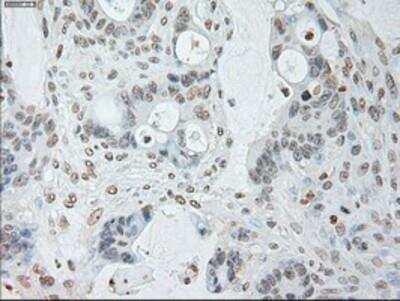 Immunohistochemistry-Paraffin: IL-6 Antibody (OTI3G9) [NBP1-47810]