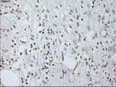 Immunohistochemistry-Paraffin: IL-6 Antibody (OTI3G9) [NBP1-47810]