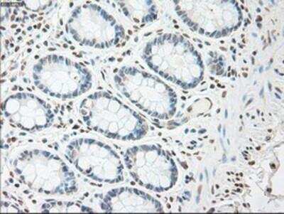 Immunohistochemistry-Paraffin: IL-6 Antibody (OTI3G9) [NBP1-47810]