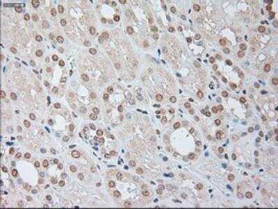 Immunohistochemistry-Paraffin: IL-6 Antibody (OTI3G9) [NBP1-47810]