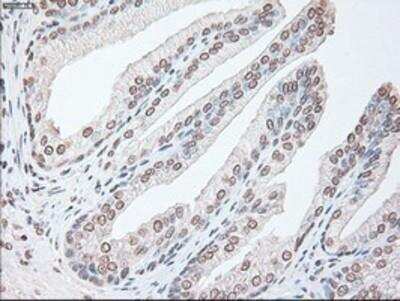 Immunohistochemistry-Paraffin: IL-6 Antibody (OTI3G9) [NBP1-47810]