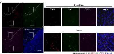 Immunohistochemistry: IL-6 Antibody [NB600-1131]