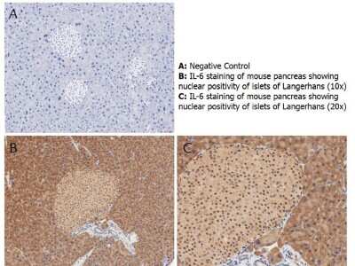 Immunohistochemistry: IL-6 Antibody [NBP1-77894]