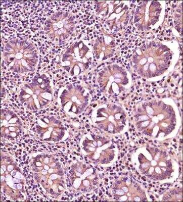 Immunohistochemistry-Paraffin: IL-6 Antibody - BSA Free [NBP2-78132]