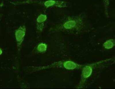 Immunocytochemistry/ Immunofluorescence: IL-6 Antibody (OTI3G9) - Azide and BSA Free [NBP2-71027]