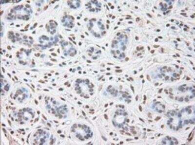 Immunohistochemistry-Paraffin: IL-6 Antibody (OTI3G9) - Azide and BSA Free [NBP2-71027]