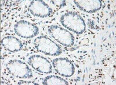 Immunohistochemistry-Paraffin: IL-6 Antibody (OTI3G9) - Azide and BSA Free [NBP2-71027]
