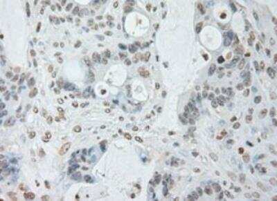 Immunohistochemistry-Paraffin: IL-6 Antibody (OTI3G9) - Azide and BSA Free [NBP2-71027]