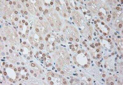 Immunohistochemistry-Paraffin: IL-6 Antibody (OTI3G9) - Azide and BSA Free [NBP2-71027]
