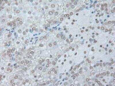 Immunohistochemistry-Paraffin: IL-6 Antibody (OTI3G9) - Azide and BSA Free [NBP2-71027]