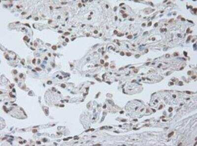 Immunohistochemistry-Paraffin: IL-6 Antibody (OTI3G9) - Azide and BSA Free [NBP2-71027]
