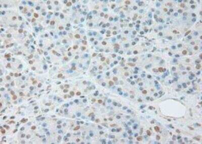 Immunohistochemistry-Paraffin: IL-6 Antibody (OTI3G9) - Azide and BSA Free [NBP2-71027]