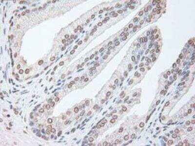 Immunohistochemistry-Paraffin: IL-6 Antibody (OTI3G9) - Azide and BSA Free [NBP2-71027]