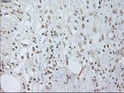 Immunohistochemistry-Paraffin: IL-6 Antibody (OTI3G9) - Azide and BSA Free [NBP2-71027]