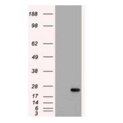 Western Blot: IL-6 Antibody (OTI3G9)Azide and BSA Free [NBP2-71027]
