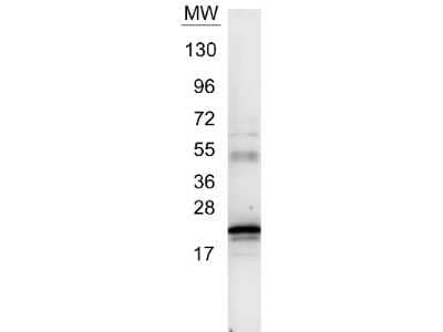 Western Blot: IL-6 Antibody [NB600-1131]