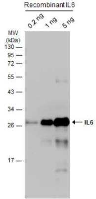 Western Blot: IL-6 Antibody [NBP2-16957]