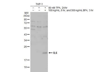 Western Blot: IL-6 Antibody [NBP2-16957]