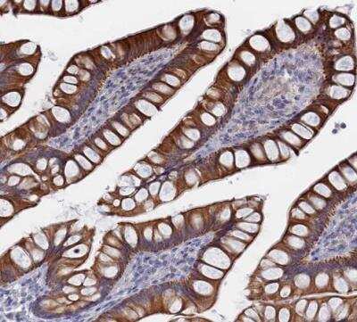 Immunohistochemistry-Paraffin: IL-7 Antibody [NBP1-83111]